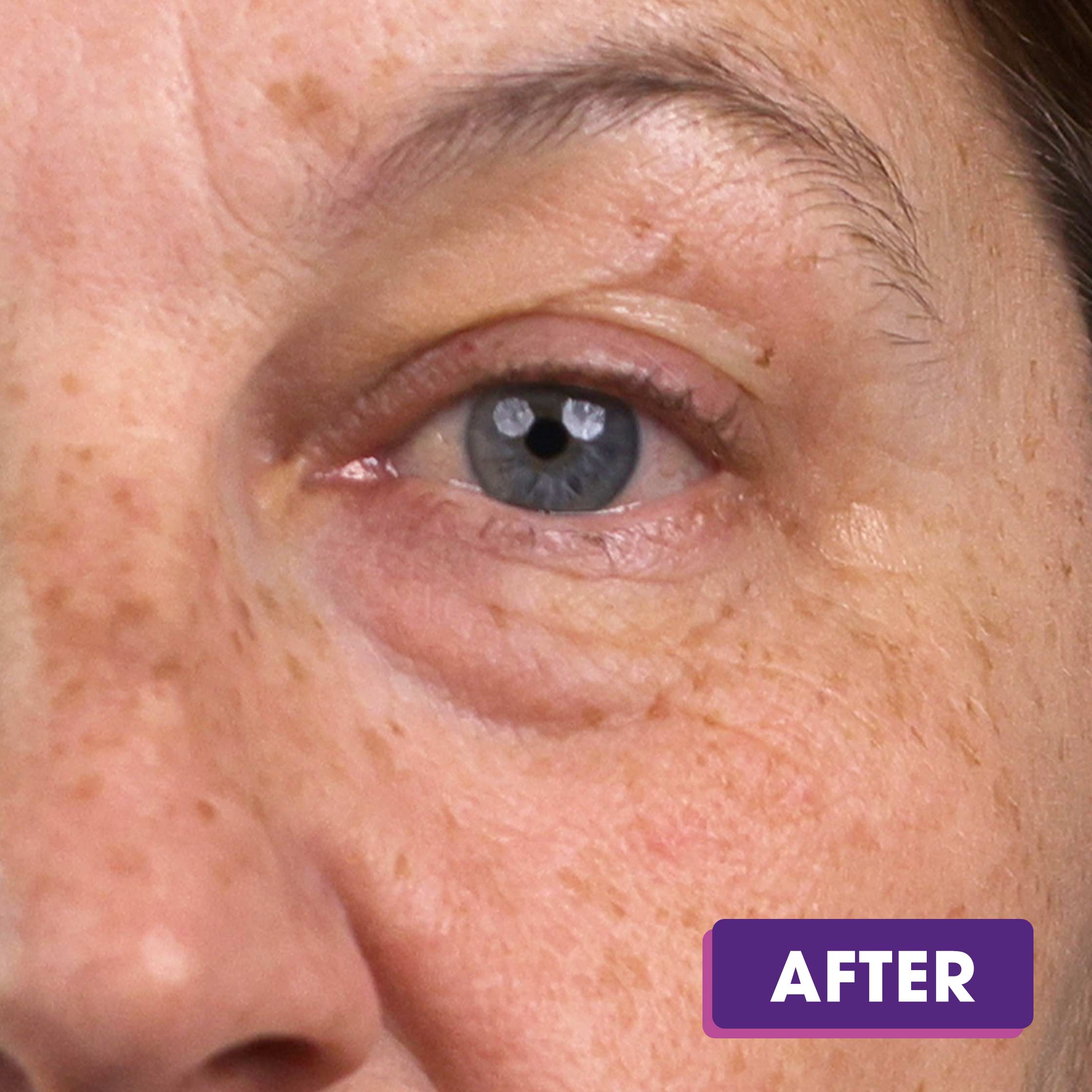 Beauty-Collagen-B_As-AFTER-1.jpg