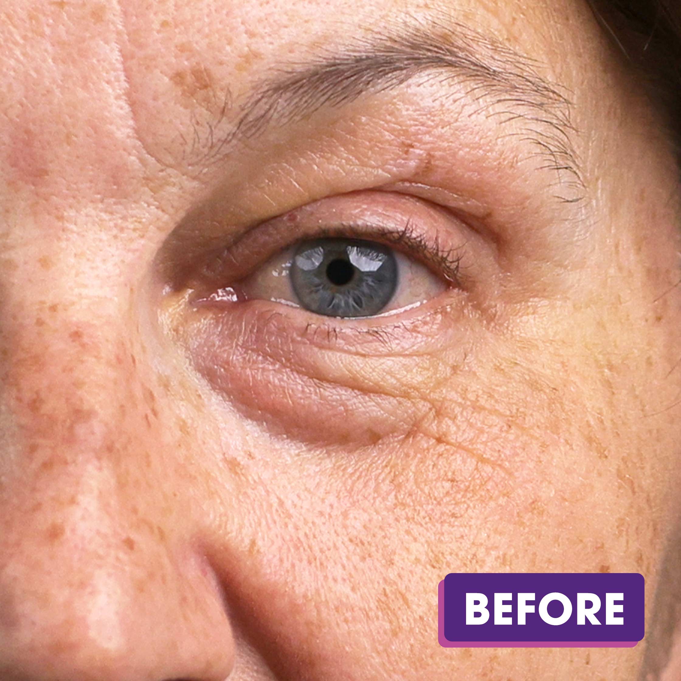Beauty-Collagen-B_As-BEFORE-1.jpg